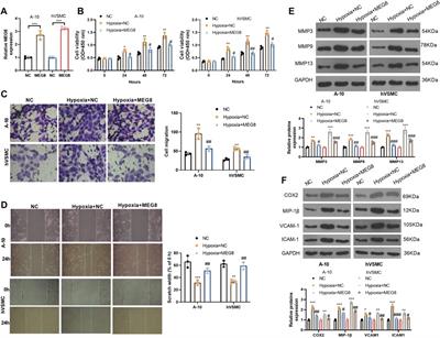 Long Non-Coding RNA MEG8 Suppresses Hypoxia-Induced Excessive Proliferation, Migration and Inflammation of Vascular Smooth Muscle Cells by Regulation of the miR-195-5p/RECK Axis